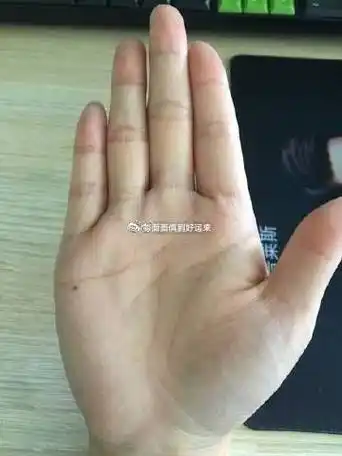 感情线交汇再分叉,加上小指下方的感情线下方有明显的痣,不要聪明反被