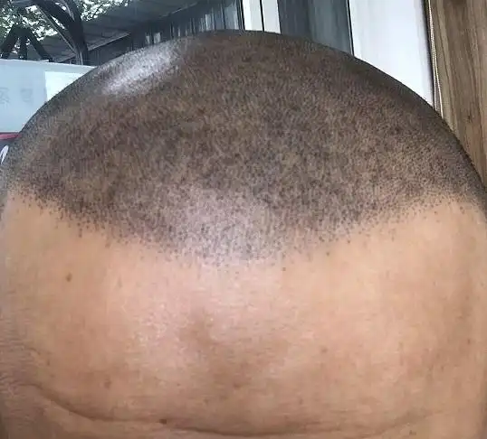 纹发的误区:纹发不是越黑越好