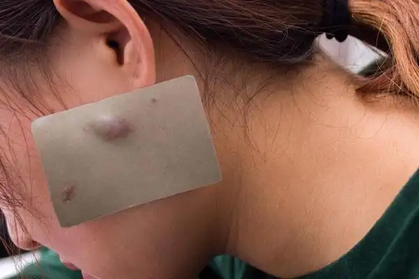 皮肤上莫名其妙长出来的"小肉球",是什么物质?能直接抠掉吗?