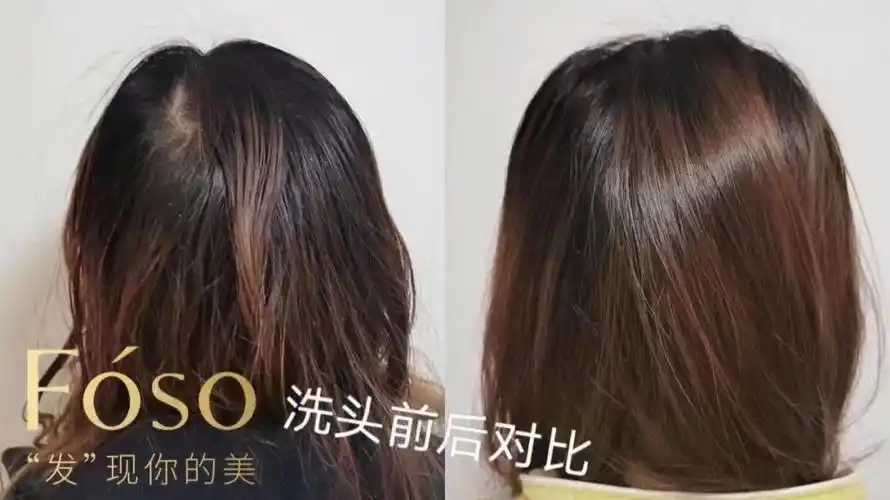 干枯毛燥油性发质有头皮问题的姐妹来