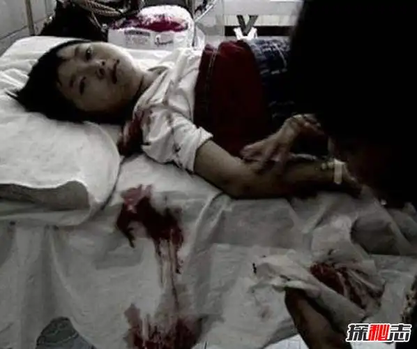 小苏丽事件是真的吗小苏丽验尸照片死后遭亲生母亲扒坟