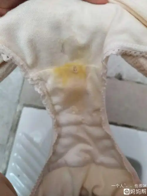 疏导情绪!怀孕了白带是什么症状"春光明媚"-第2张图片-西安论坛资讯