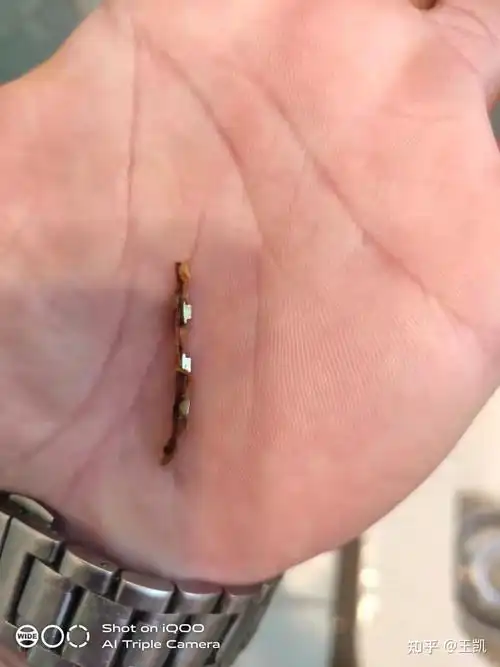 今天下午取出一个钉子,以为还剩一个,于是努力想把它取出,结果发现