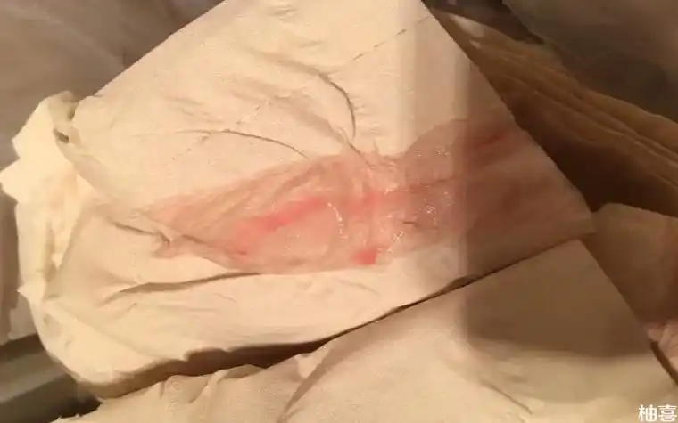 取卵第10天同房后少量出血的情况正常吗