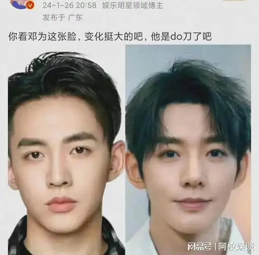 男顶流疑整容do脸还没有原来好看
