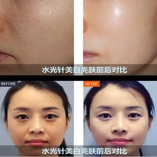 涂抹式水光针原液oem代加工 美白补水保湿紧致嫩肤 化妆品.