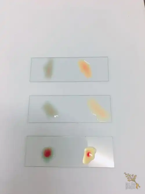 为什么做血型鉴定我的血会凝在中间,都是o型血,最下面那个是我的