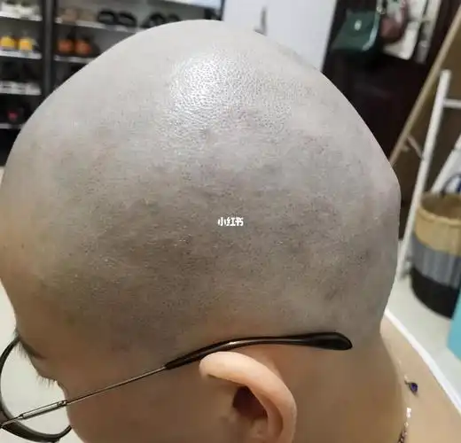 光头第13天 刮第6次_光头女生_时尚_发型