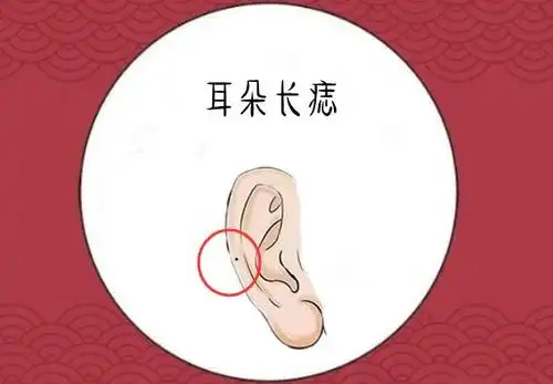 耳朵长痣是吉是凶?