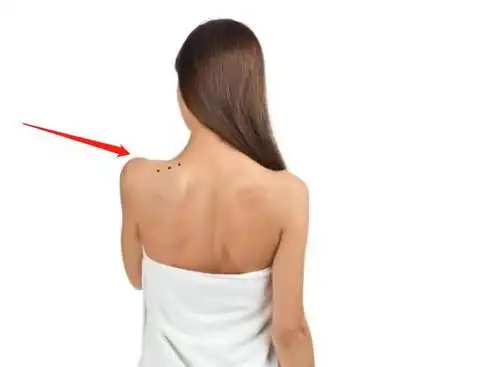 后背上这3种痣最有福第1种健康长寿第2种事业有成