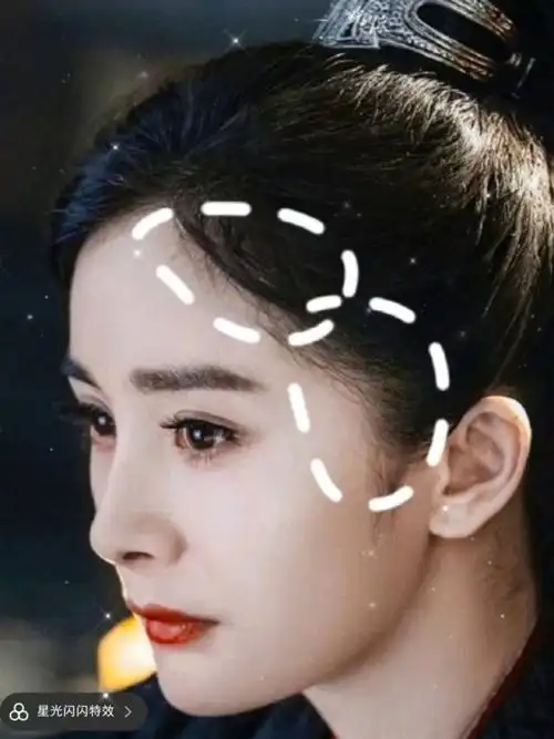 杨幂的发际线为什么越来越好看