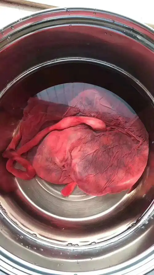 全国出售胎盘紫河车健康冷冻新鲜胎盘