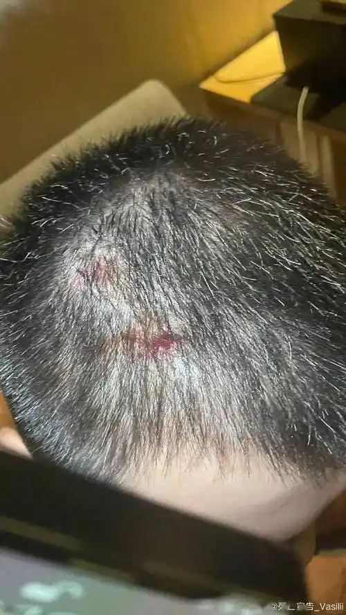 一物降一物死亡宣告遭老婆平底锅爆头流血网友你也有今天