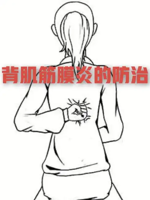 01背肌筋膜炎是一种由慢性劳损,潮湿,寒冷环境刺激导致背部肌肉血管