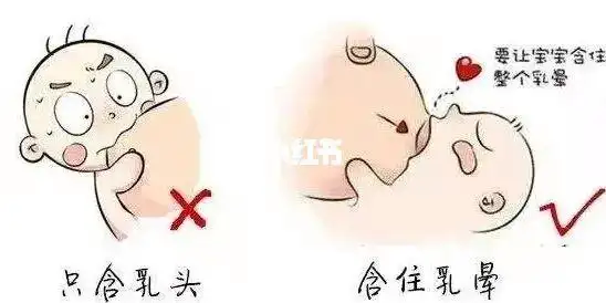 93当妈妈刚生完孩子并开始母乳喂养时,轻微的乳头压痛是正常的.