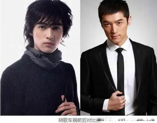 胡歌是怎么出车祸的 胡歌出车祸后容貌变了