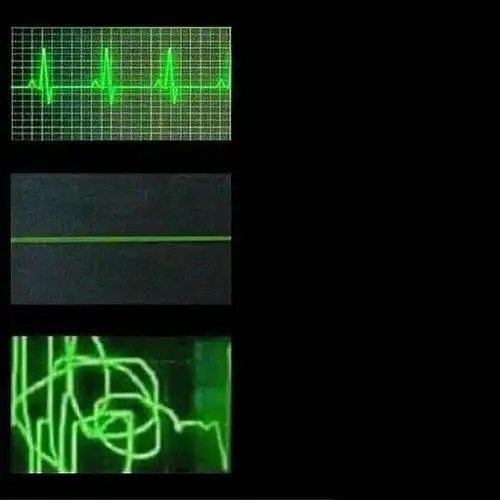 最近存的一批空白的梗图