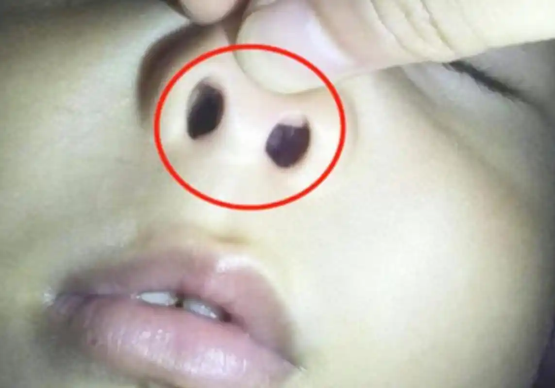 从小爱挖鼻孔的孩子长大后会怎么样专家逃不掉几种结局