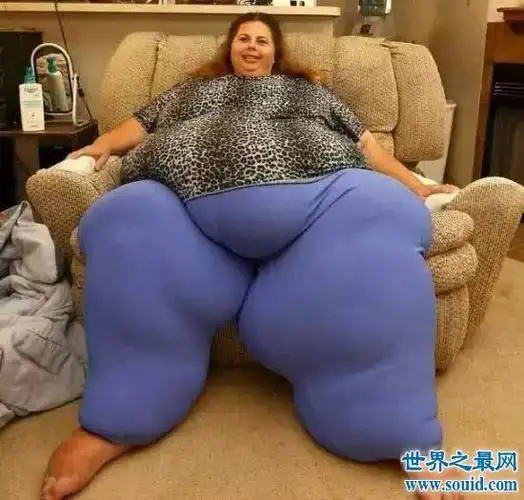 十个世界上最重的人 乔恩·布劳尔最胖1257斤!出门靠抬