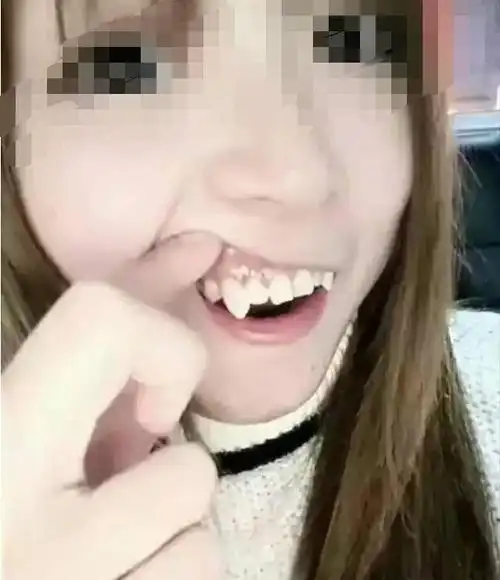 长虎牙的女孩有福气吗,虎牙是旺夫还是克夫? 本文共(920字)