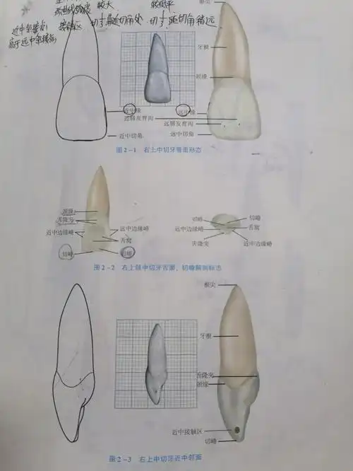 上颌中切牙(上1)1   切牙中体积最大(面型一般与唇面外形相匹配,有卵