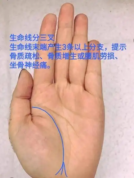 手掌主线之:生命线下