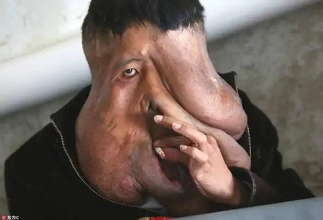 全球三个最丑的男人第三个娶过2个老婆还是8个孩子的父亲