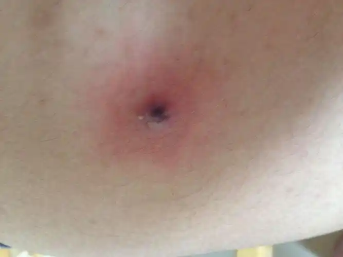 不碰不会痛.一碰