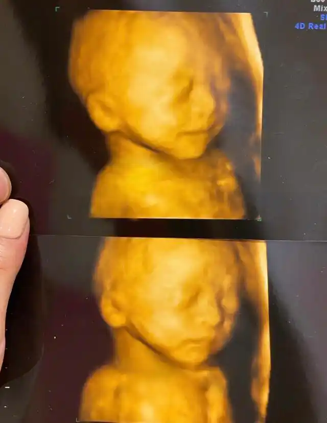 宁桓宇首晒儿子正脸眉清目秀像小女孩儿直呼不敢再说喜欢女儿