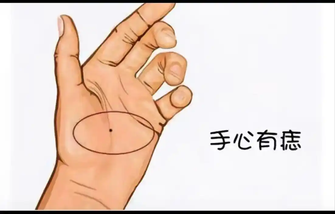 老人说左手突然出现的痣,是你三观六劫九难都已 过,从此就一帆 - 抖音
