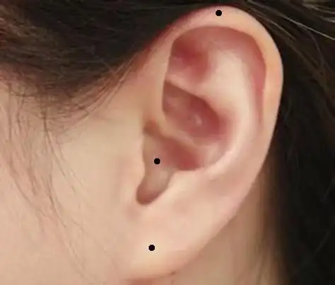 这是一种福相,假如再生有痣的话,表示其人心地善良,有福气,常有好运