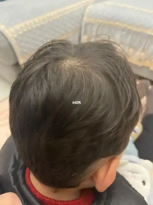 一岁四个月有两根白头发