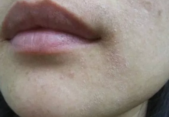 泛红,刺痛,起皮,紧绷,干燥,你的肌肤到底怎么了?