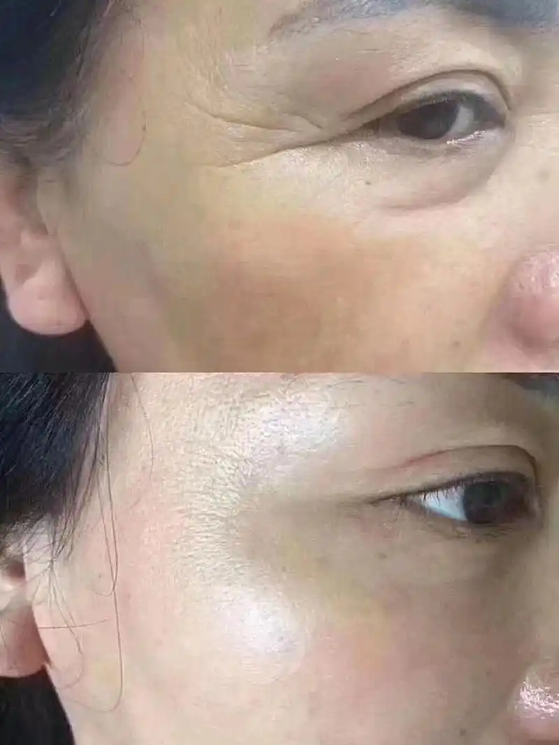 停了会不会更老?