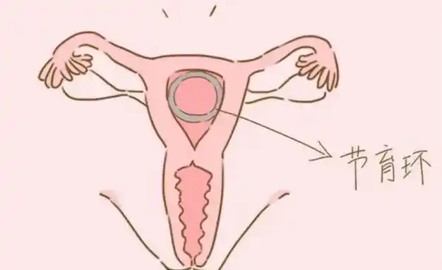 月经周期结束后为何会出现褐色分泌物关键是保持健康