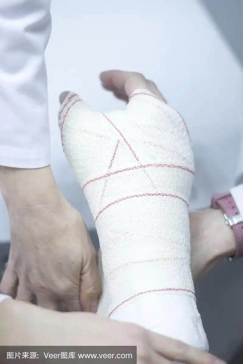 骨折后,医生在患者前臂和手腕上使用石膏石膏和绷带固定.