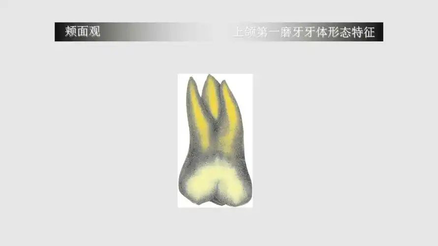 上颌第一磨牙牙体形态简述