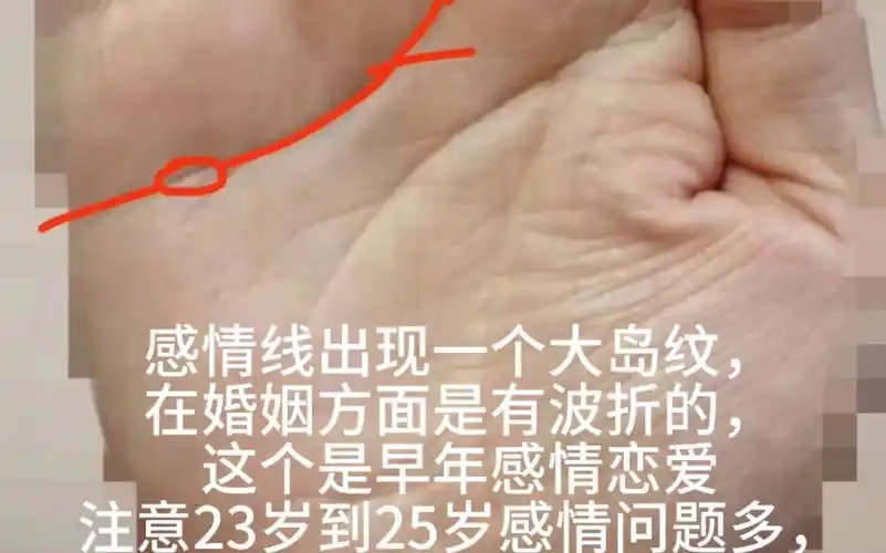 感情线上有岛纹会怎么样?