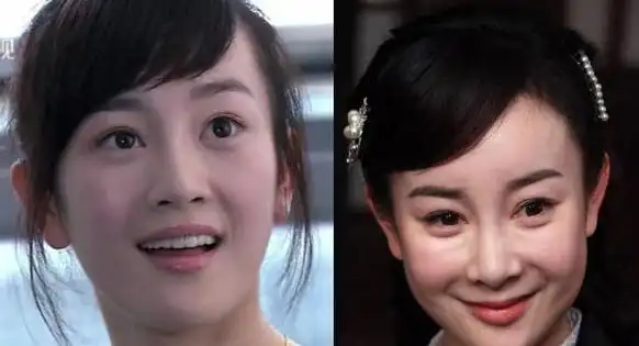 哪些明星承认整容 哪些明星承认整容失败