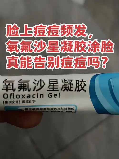 氧氟沙星凝胶,这个看似普通的药膏,在一些人的祛痘攻略中频繁出现