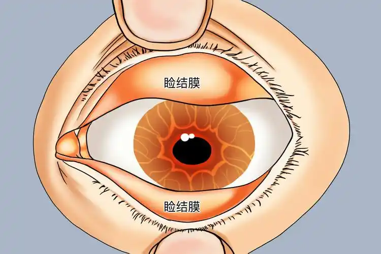 眼睑内是哪里图片_有来医生