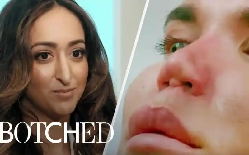 慎点那些整容失败真实案例各个都触目惊心油兔不二字幕组