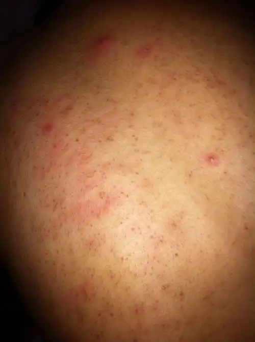 背上长得是什么