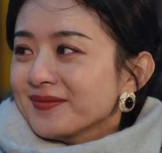 有种"颜值杀手"叫赵丽颖发腮,刘亦菲发腮才是"元凶"_少女_饼子_五官