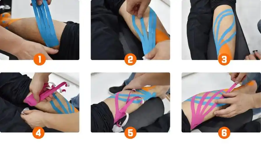 点击图片,查看大图以上是关于肌贴在跑步运动中的预防