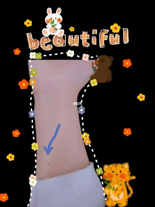 谁的奶奶或外婆有没有说过手臂有痣