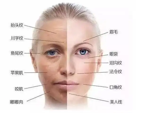 lipozero魔立塑减肥塑形美容仪