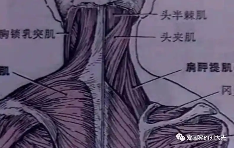 颈项僵痛之肩胛提肌损伤