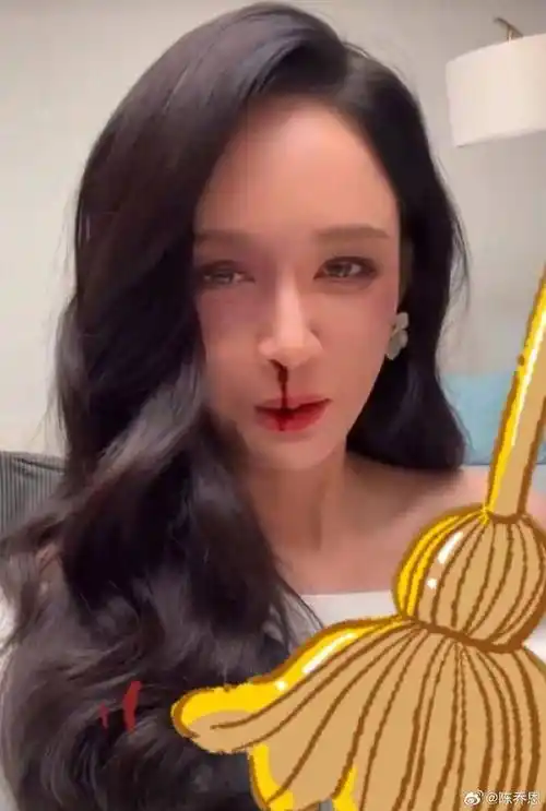 史上第一位女星!陈乔恩认领「金扫帚奖影后」 流鼻血po得奖感言