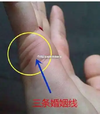 婚姻线可以代表人的爱情观念,早婚或是晚婚,那三条婚姻线都有什么含义